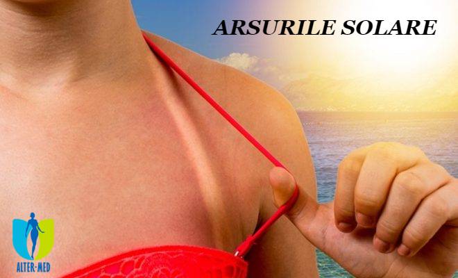 articol-tratament-arsuri-solare