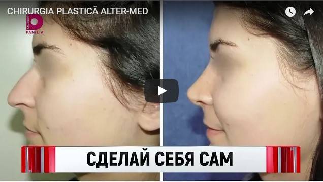 articol-reportaj-cu-chirurgi-altermed