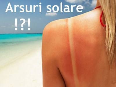 articol-arsurile-solare-pasii-tai