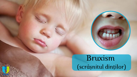 bruxim_-_scrnitul_dinilor_1 image bruxim_-_scrnitul_dinilor_1 Bruxism - Clinica de Medicină Estetică și Chirurgie Plastică
