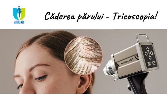 articol-caderea-parului-trihoscopie-chisinu.png
