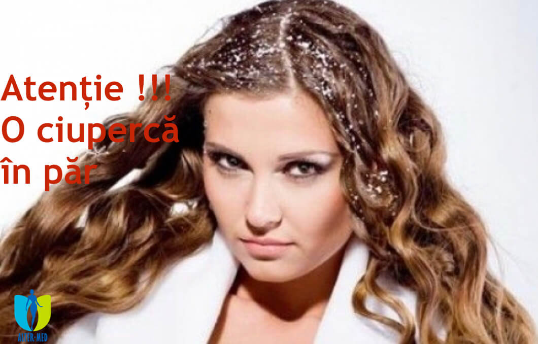 articol-ciupearca-in-par-ce-sa-faci