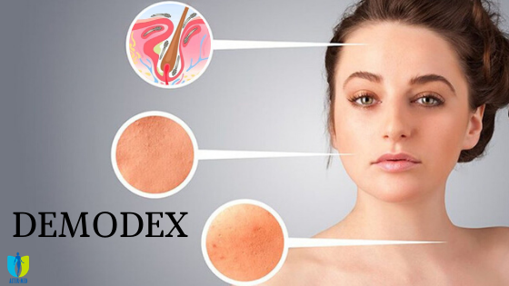 demodex image demodex Articolele clinicii estetice | Pagina 1 | Alter-MED