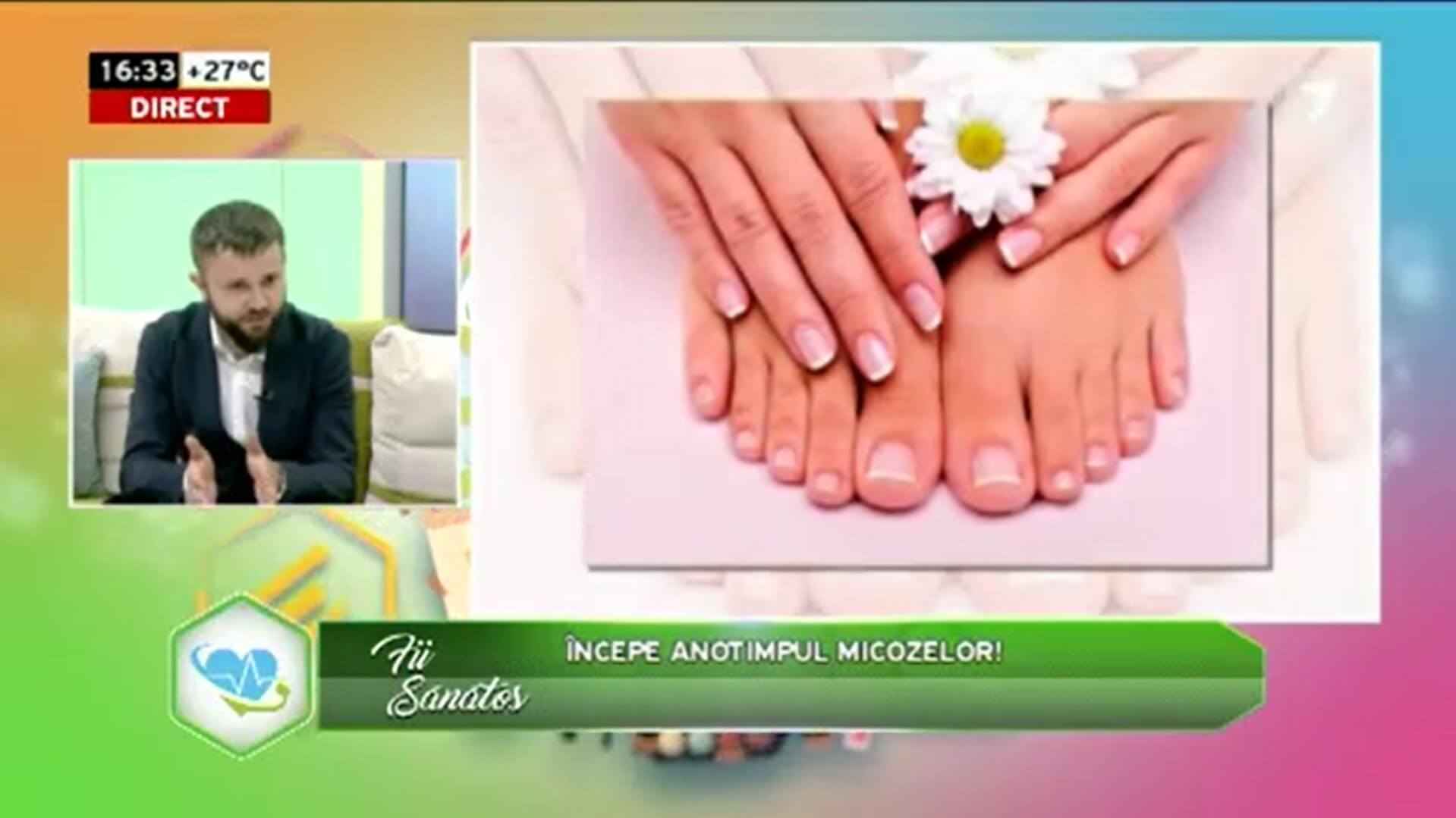 articol-totul-despre-micozele-tratament
