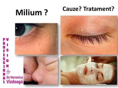articol-milium-tratarea-chisinau