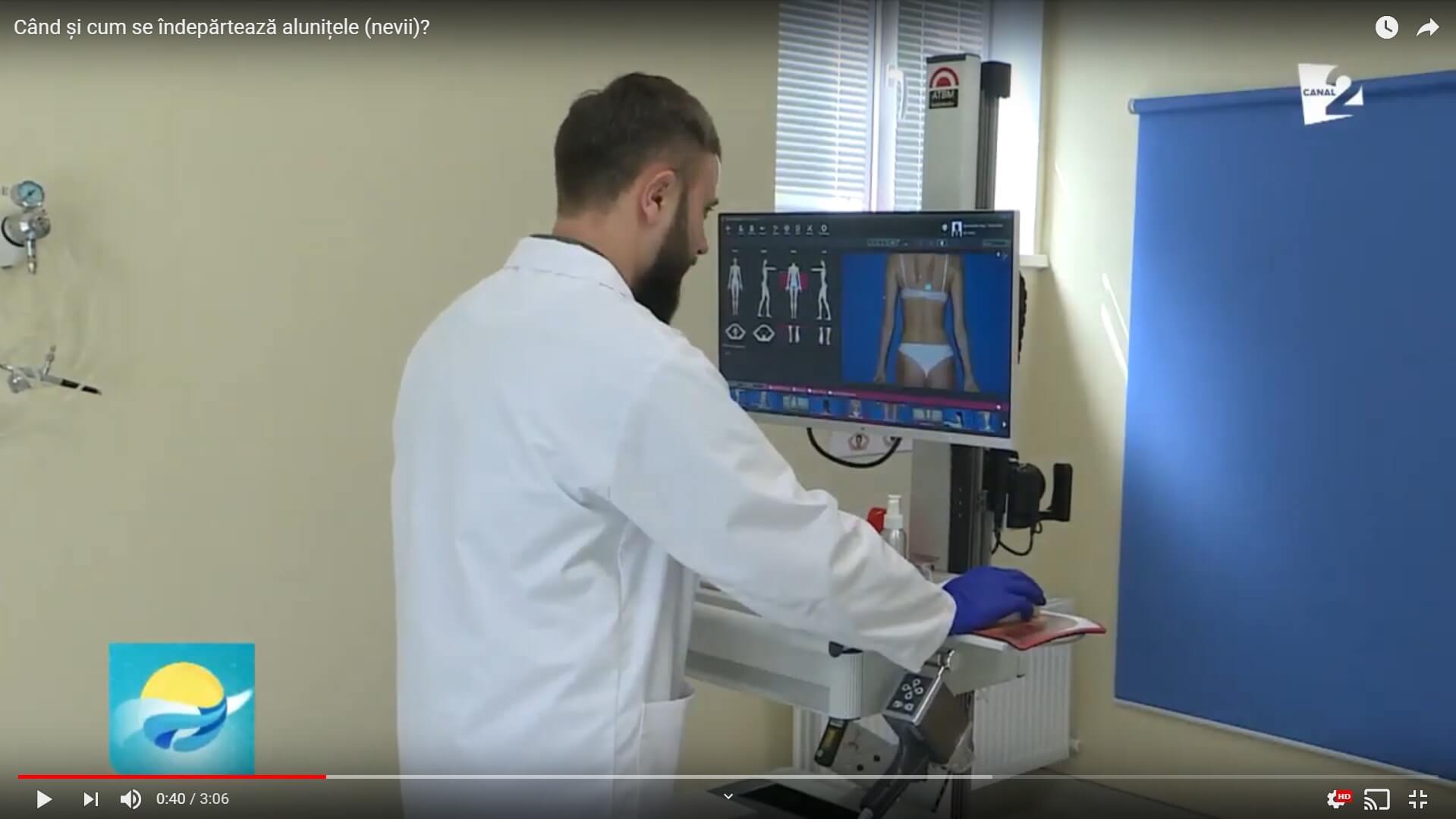 articol-indepartare-alunite-altermed