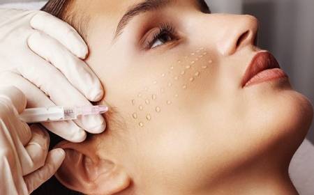 biorevitalizare Biorivitalizzazione - Clinica de Medicină Estetică și Chirurgie Plastică