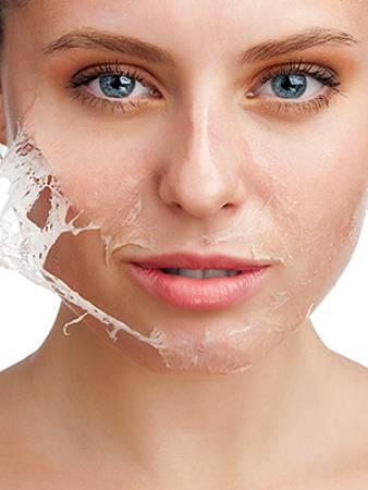 peeeling Peeling - Clinica de Medicină Estetică și Chirurgie Plastică